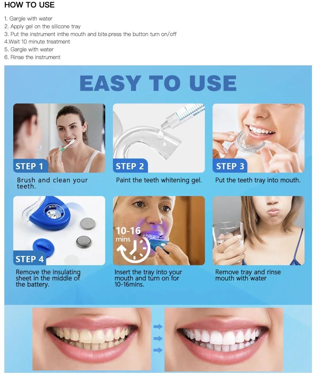 Home Teeth Whitening Kit – 44% Peroxide Gel with Dental Brush